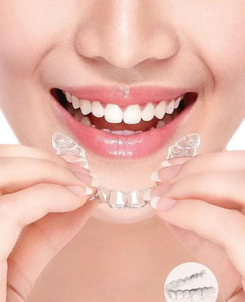 矫正牙齿隐形天使-图2