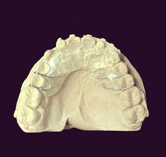 牙齿矫正导板图片能看出矫正效果吗？-图1