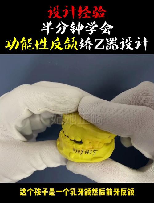 牙齿矫正导板图片能看出矫正效果吗？-图2