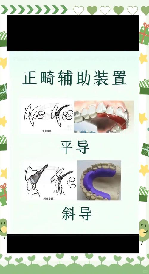 牙齿矫正导板图片能看出矫正效果吗？-图3