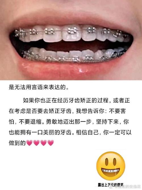 贵阳牙齿矫正怎么样？价格效果机构如何选？-图2