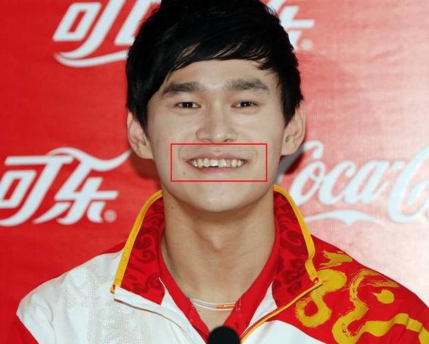 孙杨矫正牙齿图片曝光？他矫正牙齿的原因和效果如何？-图2