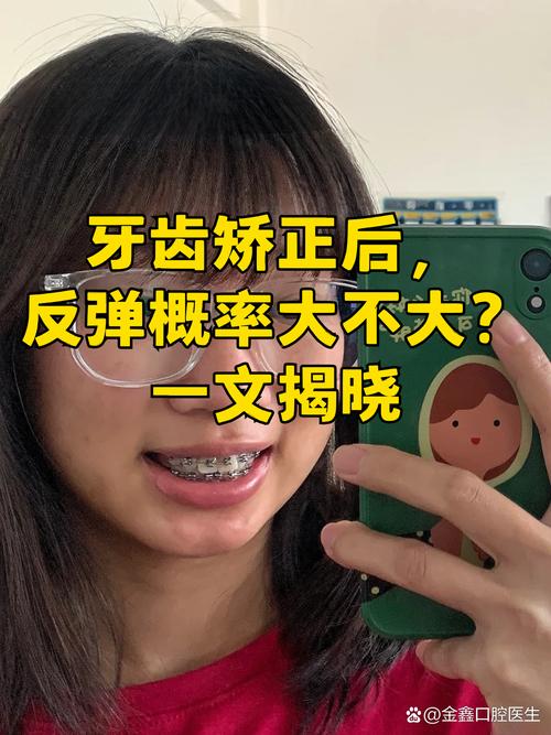 矫正牙齿反弹大吗-图1 矫正牙齿反弹大吗-图1