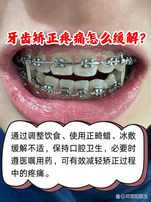 正畸矫正牙齿矫正过程会疼吗？-图1