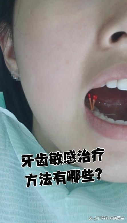 矫正期间牙齿敏感-图3 矫正期间牙齿敏感-图3