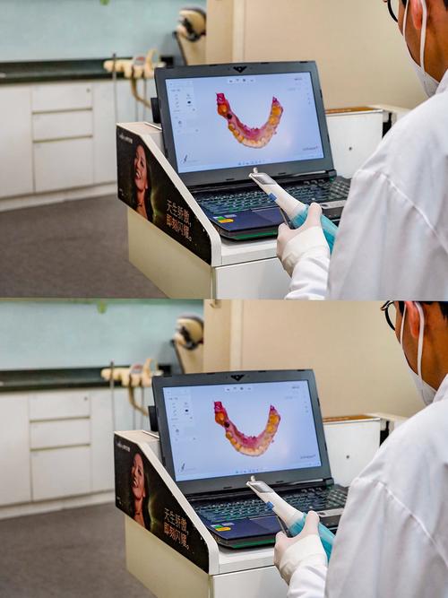 福州牙齿矫正排名怎么参考？靠谱吗？-图3