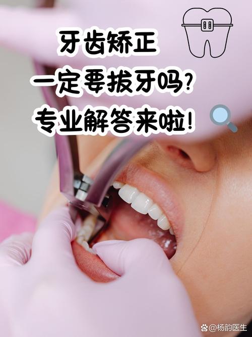 矫正牙齿一定要拔门牙吗？专家解析拔门牙矫正的注意事项-图1