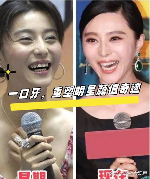 明星晒矫正牙齿照，有何深层用意？-图1
