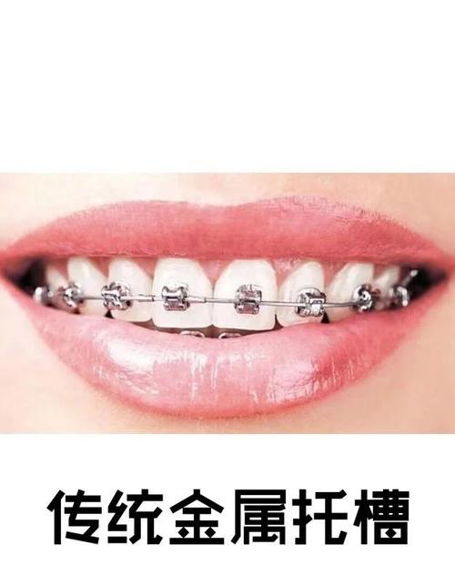 矫正牙齿哪里比较靠谱？效果与价格如何选？-图2