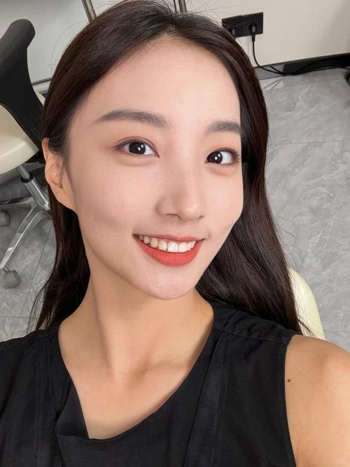 牙齿矫正 33岁-图2