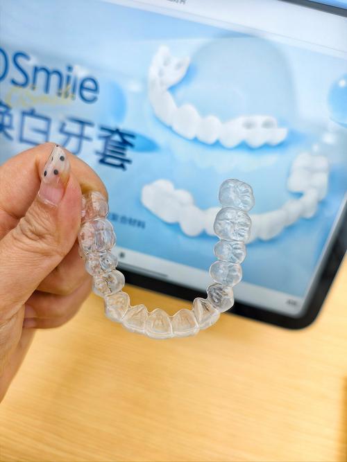 广州隐形矫正牙齿效果如何？有哪些优势？选择哪家好？-图1