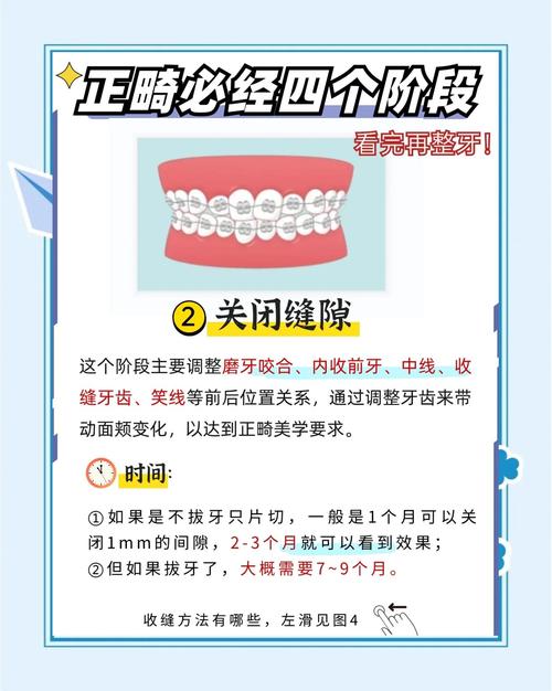 矫正牙齿整个过程一般需要多少年才能完成？-图2
