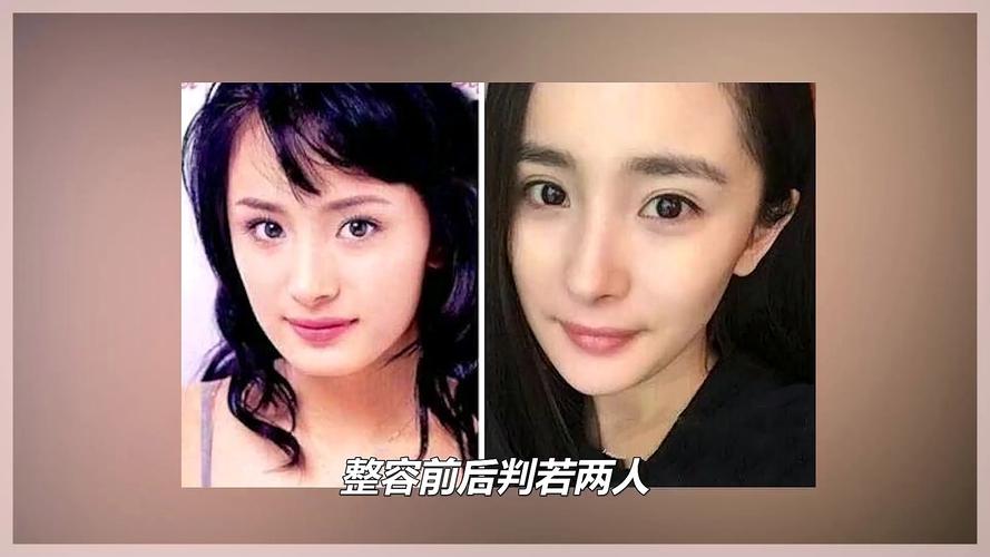 杨幂牙齿矫正前后变化有多大？-图2