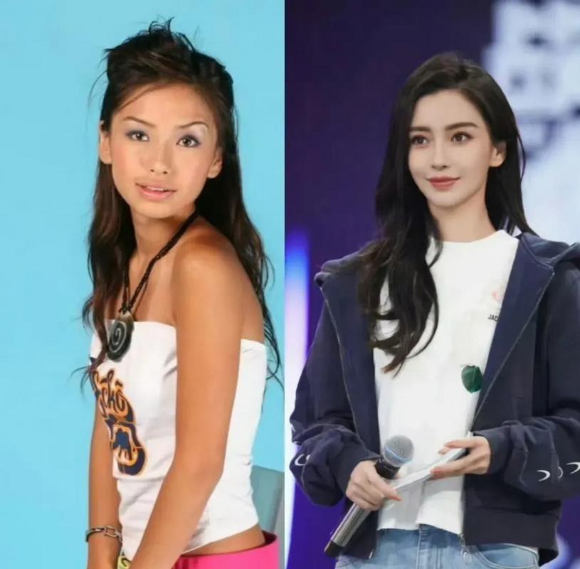 杨颖牙齿矫正前后颜值变化大吗？效果引网友热议！-图2