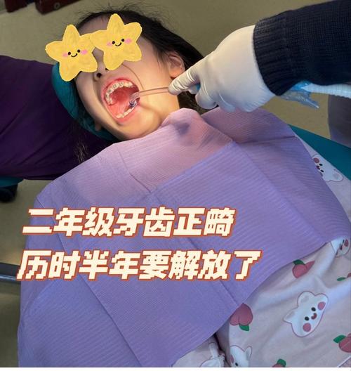 小孩牙齿矫正痛吗?家长必知的疼痛解答与缓解指南-图2 小孩牙齿矫正痛吗?家长必知的疼痛解答与缓解指南-图2