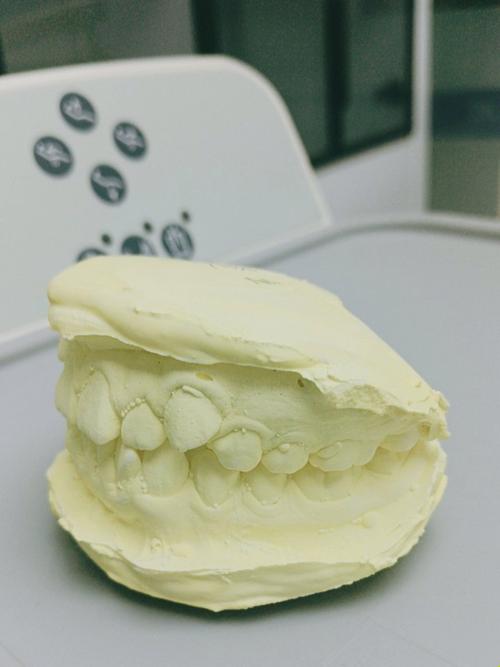 矫正牙齿不做牙模-图1