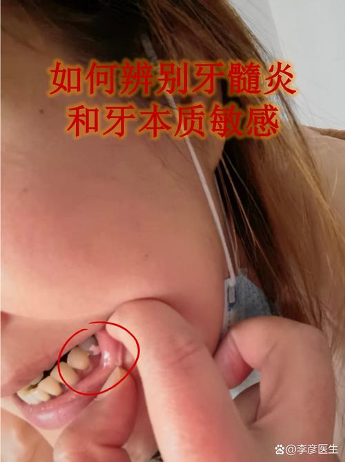 矫正牙齿磨牙会痛吗？疼痛感强吗？能忍受吗？-图1