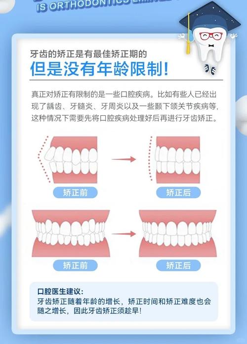 做牙齿矫正的缺点-图2