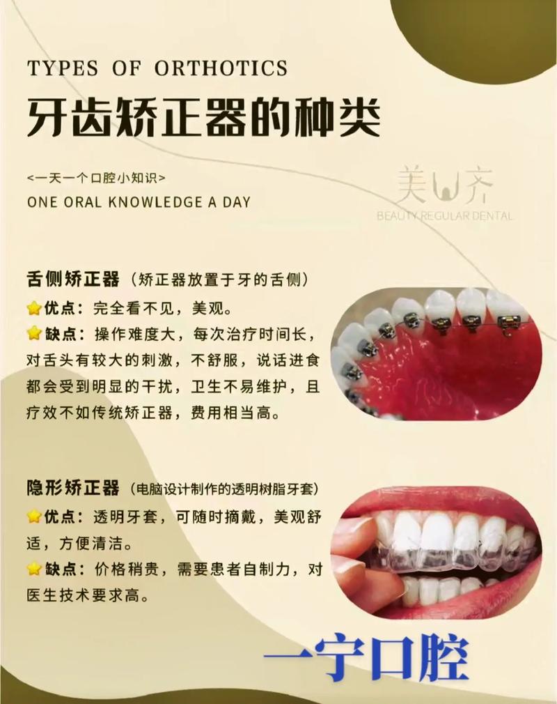 牙齿矫正贵在哪里-图1 牙齿矫正贵在哪里-图1