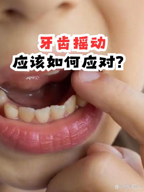 牙齿矫正门牙摇动是正常现象吗？需要处理吗？-图1