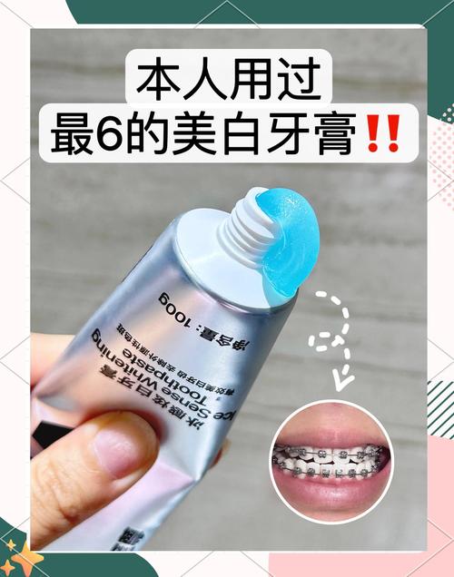 牙齿矫正能让牙齿变白吗？-图1