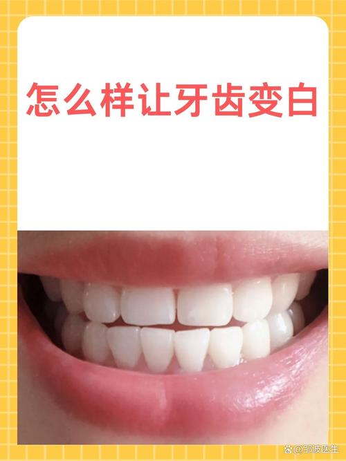 牙齿矫正能让牙齿变白吗？-图2