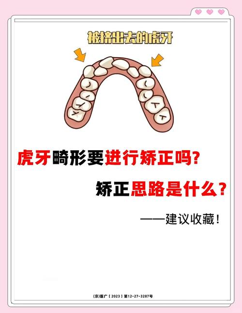 有歪牙齿怎么矫正-图2