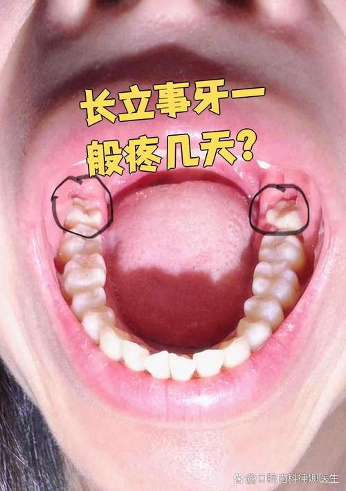 牙齿矫正时长是否会因智齿位置或拔除情况而变化？-图1