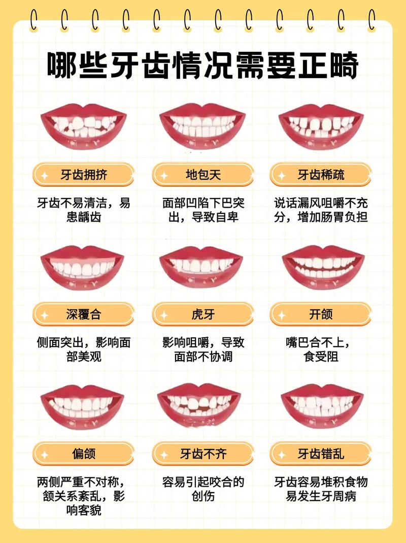 牙齿矫正适合人群-图1