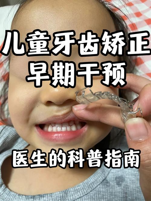 上海小儿牙齿矫正，几岁开始矫正效果最佳？-图1