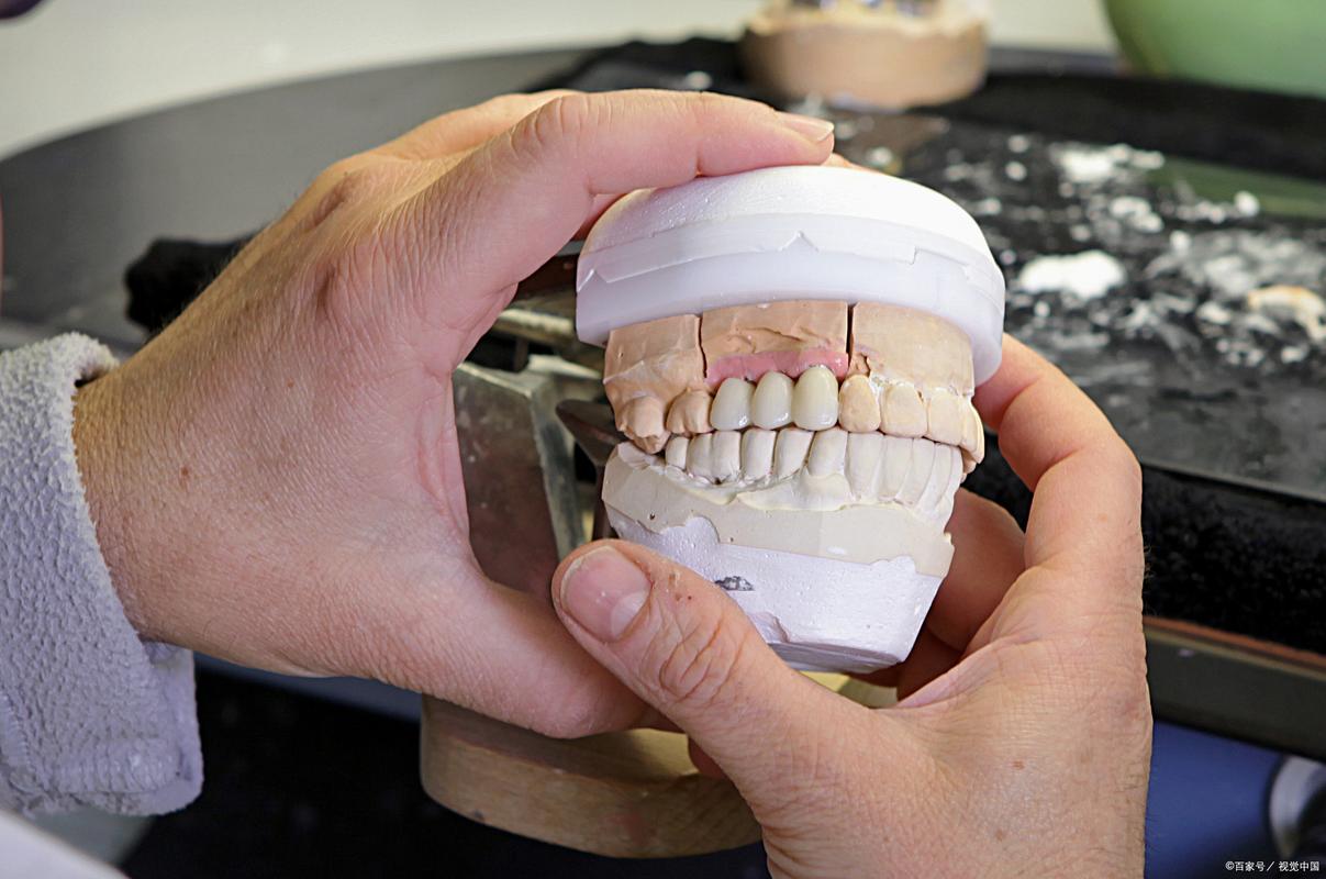 上海矫正牙齿与镶牙，哪种更适合？-图2