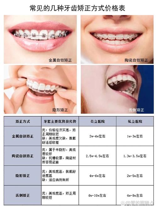 珠海矫正牙齿价格-图3 珠海矫正牙齿价格-图3