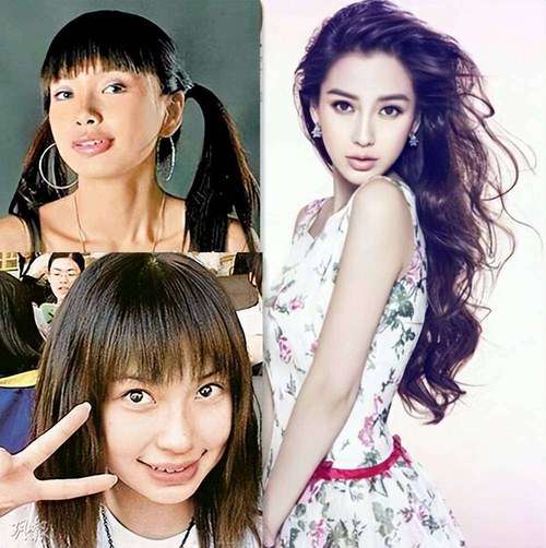 杨颖矫正牙齿前后-图1