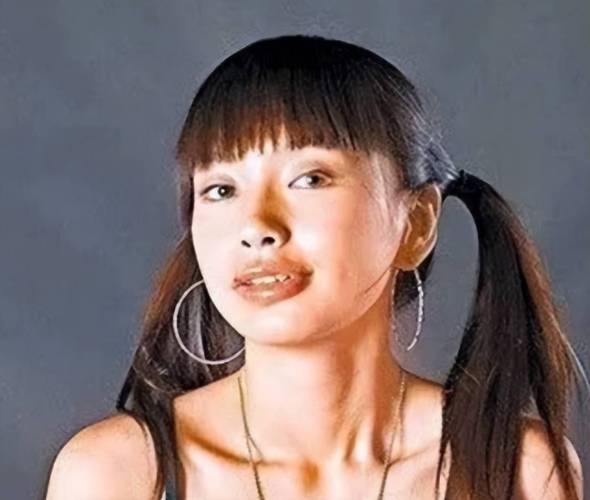 杨颖矫正牙齿前后-图2