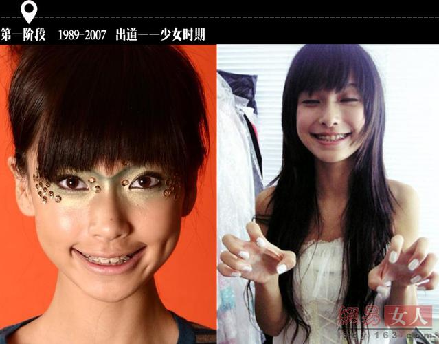 杨颖矫正牙齿前后-图3