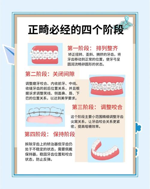 矫正牙齿必须磨牙吗?磨牙是矫正的必要步骤吗?-图1 矫正牙齿必须磨牙吗?磨牙是矫正的必要步骤吗?-图1