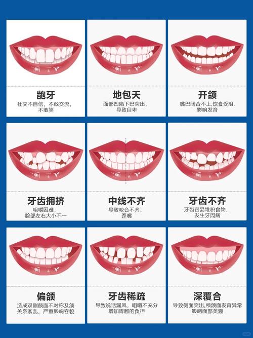 医院牙齿矫正排行哪家强?靠谱依据是什么?-图1 医院牙齿矫正排行哪家强?靠谱依据是什么?-图1