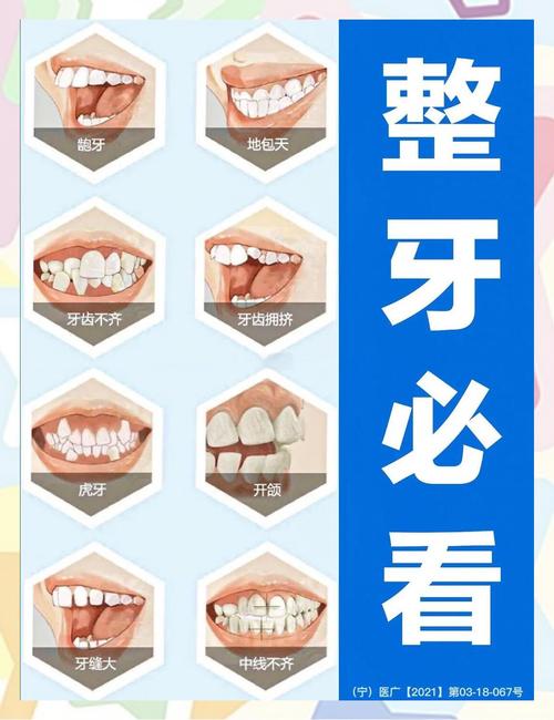 医院牙齿矫正排行哪家强?靠谱依据是什么?-图3 医院牙齿矫正排行哪家强?靠谱依据是什么?-图3