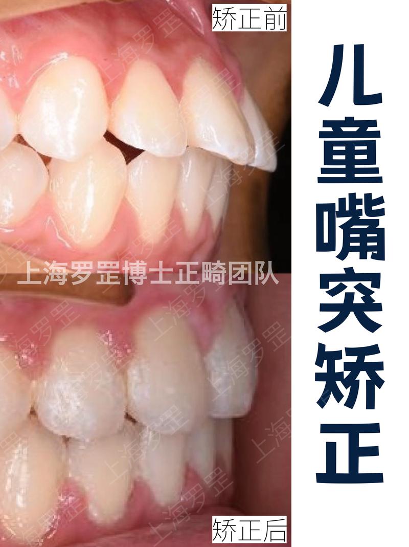 全国连锁牙齿矫正,选品牌还是看医生?-图2 全国连锁牙齿矫正,选品牌还是看医生?-图2