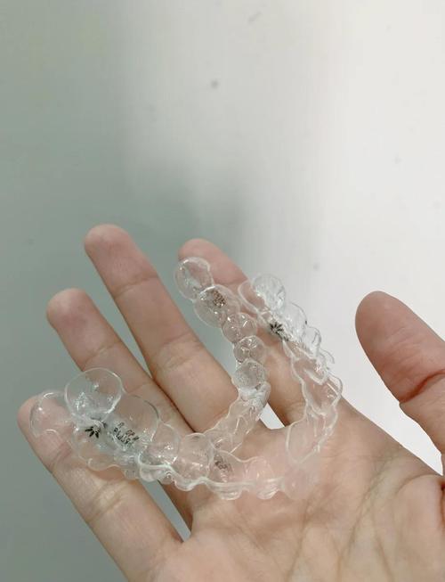 隐形矫正牙齿好不好？效果、舒适度、价格怎么样？-图1