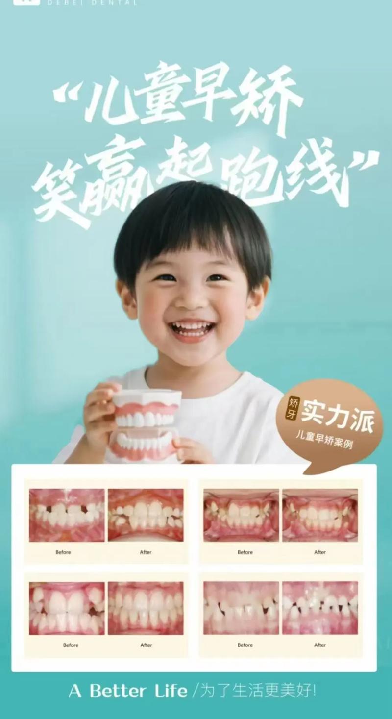 暑假牙齿矫正活动，值不值得参与？-图3