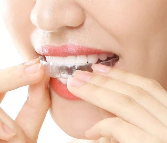 佳德口腔矫正牙齿效果好吗？适合哪些人？-图1