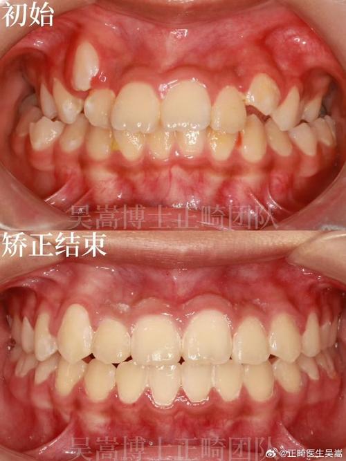 南京矫正牙齿去哪做？靠谱牙科机构怎么选？-图3