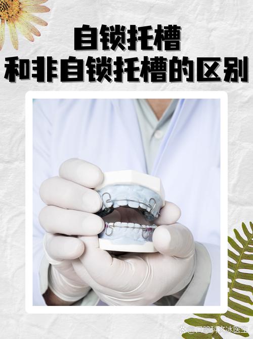 自锁矫正牙齿的原理是什么？如何实现牙齿移动？-图3