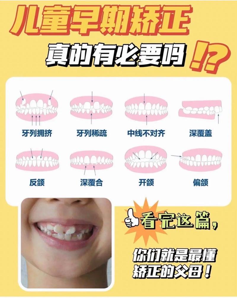 牙齿矫正有年龄限制吗？多大就不能矫正了？-图3