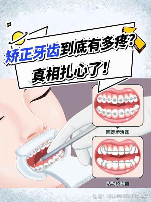 矫正牙齿加力疼不疼？加力后的疼痛感有多强？-图2