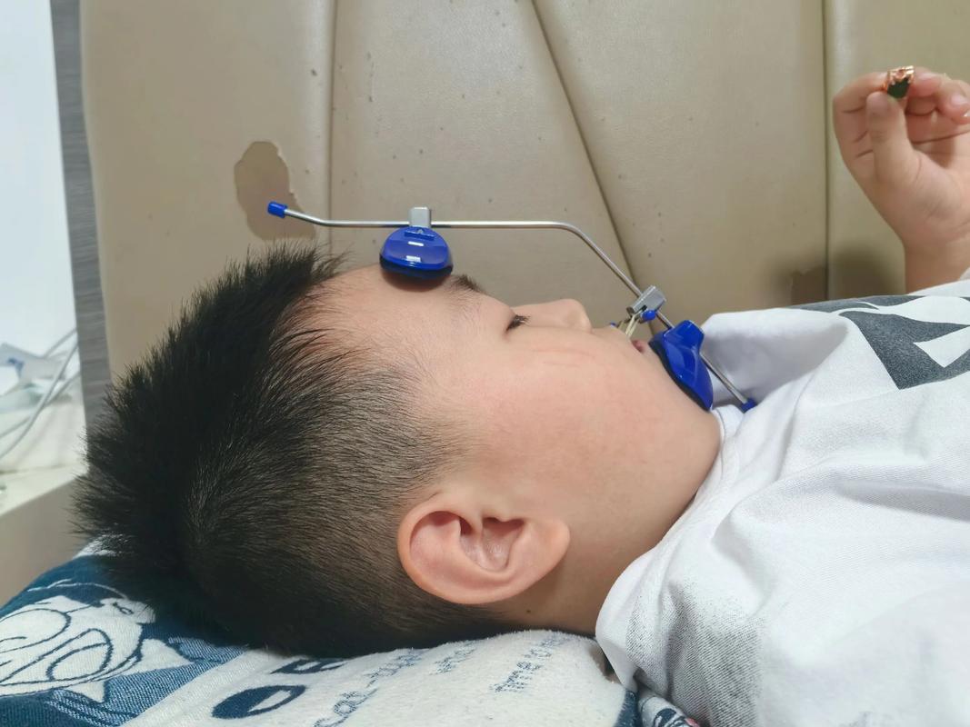 男孩牙齿矫正拔牙-图3