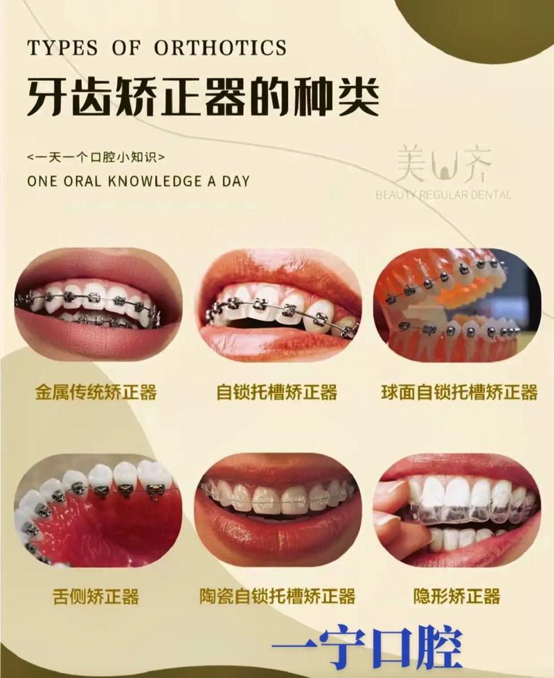 手术矫正牙齿好吗-图2