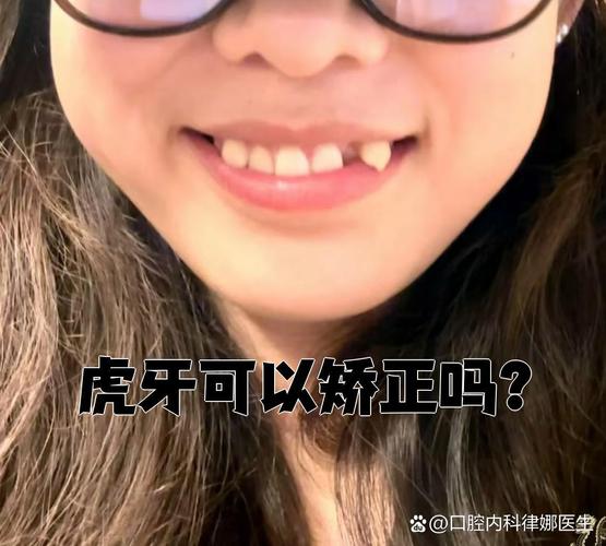 不拔虎牙矫正牙齿，效果与美观能兼顾吗？-图1