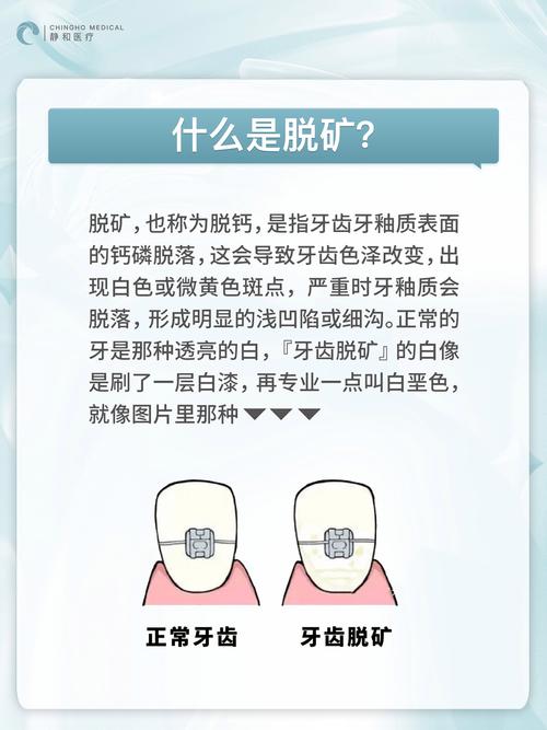 牙齿矫正真的会有后遗症吗?-图1 牙齿矫正真的会有后遗症吗?-图1